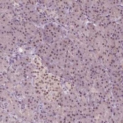 IWS1 Antibody, Novus Biologicals:Antibodies:Primary Antibodies