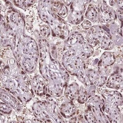 IWS1 Antibody, Novus Biologicals:Antibodies:Primary Antibodies