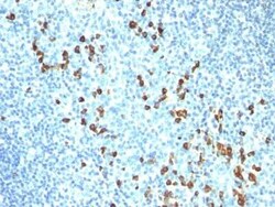 IgM Antibody (ICO-30), Novus Biologicals:Antibodies:Primary Antibodies