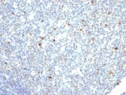 IgM Antibody (IM260) - Azide and BSA Free, Novus Biologicals 0.1 mg; Unconjugated:Antibodies,