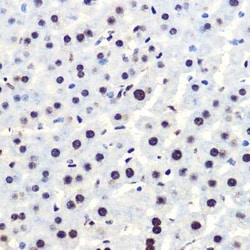 IkB-alpha Rabbit anti-Human, Mouse, Rat, Clone: 8G1X10, Novus Biologicals:Antibodies:Primary