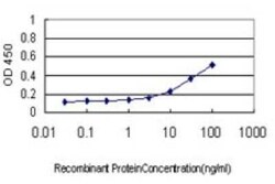 IkB-beta Antibody (1B5), Novus Biologicals 0.1 mg | Buy Online | Novus Biologicals | Fisher Scientific
