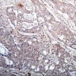 IkB-beta, p Ser23 Antibody - BSA Free, Novus Biologicals IkB-beta Antibody;