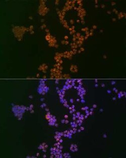 Ikaros/IKZF1 Rabbit anti-Human, Mouse, Clone: 4S10I3, Novus Biologicals