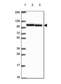 Importin 11 Antibody, Novus Biologicals:Antibodies:Primary Antibodies
