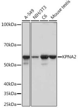Importin alpha 2/KPNA2 Rabbit anti-Human, Mouse, Rat, Clone: 9T3V8, Novus