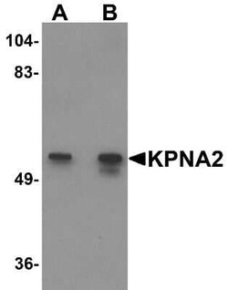 Importin alpha 2/KPNA2 Antibody - BSA Free, Novus Biologicals:Antibodies:Primary