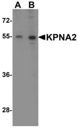 Importin alpha 2/KPNA2 Antibody - BSA Free, Novus Biologicals:Antibodies:Primary
