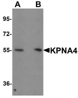 Importin alpha 3/KPNA4 Antibody - BSA Free, Novus Biologicals 0.1 mg; Unconjugated:Antibodies,