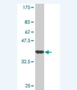 Indian Hedgehog/Ihh Antibody (2F3), Novus Biologicals 0.1 mg | Buy Online | Novus Biologicals | Fisher Scientific