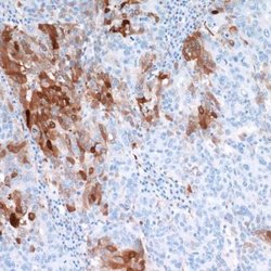 Indoleamine 2,3-dioxygenase/IDO Antibody (BLR031F), Novus Biologicals 100