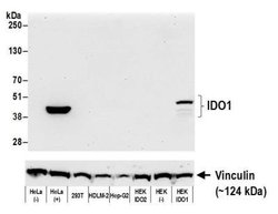 Indoleamine 2,3-dioxygenase/IDO Antibody (BLR031F), Novus Biologicals 100