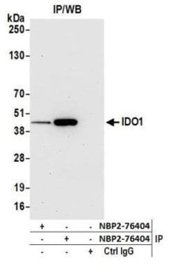 Indoleamine 2,3-dioxygenase/IDO Antibody (BLR040F), Novus Biologicals 100