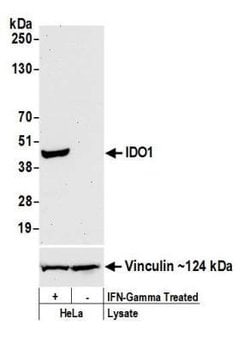 Indoleamine 2,3-dioxygenase/IDO Antibody (BLR040F), Novus Biologicals 100
