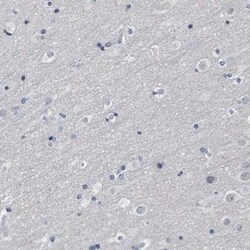 Indoleamine 2,3-dioxygenase/IDO Antibody, Novus Biologicals 0.1 mL | Buy Online | Novus Biologicals | Fisher Scientific