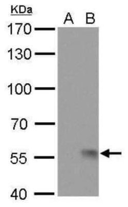 Influenza A H1N1 Neuraminidase Antibody (GT172) - (A/WSN/1933), Novus Biologicals 100 &mu;g | Buy Online | Novus Biologicals | Fisher Scientific