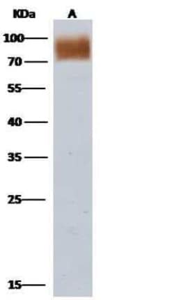 Influenza A H3N2 Neuraminidase Antibody, Novus Biologicals 100 &mu;g; Unconjugated:Antibodies,