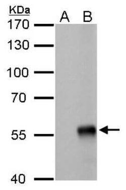Influenza A H1N1 Nucleoprotein Antibody (GT778) - (A/WSN/1933), Novus Biologicals