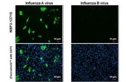 Influenza A H3N2 Nucleoprotein Antibody (HL1089) - (A/Kansas/14/2017), Novus Biologicals 100 &mu;g | Buy Online | Novus Biologicals | Fisher Scientific