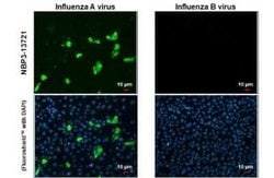 Influenza A H3N2 Nucleoprotein Antibody (HL1103) - (A/Kansas/14/2017),