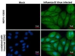 Influenza B nucleoprotein Antibody (GT382) - (B/Taiwan/753/2005), Novus Biologicals 100 &mu;g | Buy Online | Novus Biologicals | Fisher Scientific