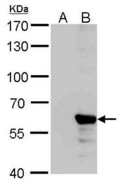 Influenza B nucleoprotein Antibody (GT382) - (B/Taiwan/753/2005), Novus Biologicals 100 &mu;g | Buy Online | Novus Biologicals | Fisher Scientific