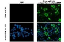 Influenza B nucleoprotein Antibody (HL1068) - (B/Taiwan/753/2005), Novus Biologicals 100 &mu;g | Buy Online | Bio-Techne | Fisher Scientific