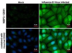 Influenza B nucleoprotein Antibody - (B/Taiwan/753/2005), Novus Biologicals 100 &mu;g | Buy Online | Novus Biologicals | Fisher Scientific