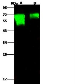 Influenza H18N11 Hemagglutinin Antibody, Novus Biologicals:Antibodies:Primary