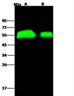 Influenza H4N6 Hemagglutinin Rabbit anti-Virus, Polyclonal, Novus Biologicals