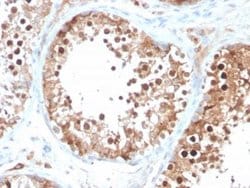 Inhibin alpha Mouse anti-Human, Clone: INHA/4266, Novus Biologicals:Antibodies:Primary