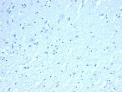 Inhibin alpha Rabbit anti-Human, Clone: INHA/6598R, Novus Biologicals:Antibodies:Primary