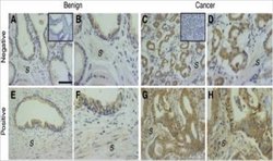 Inhibin alpha Antibody (PO12/8) - Azide and BSA Free, Novus Biologicals