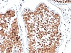 Inhibin alpha Antibody (R1) - Azide and BSA Free, Novus Biologicals 100