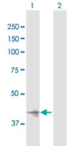 Inositol Monophosphatase 3/IMPAD1 Antibody, Novus Biologicals 0.05 mg | Buy Online | Novus Biologicals | Fisher Scientific
