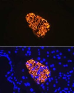 Insulin Rabbit anti-Mouse, Rat, Clone: 4C3Y9, Novus Biologicals 20 &mu;g;