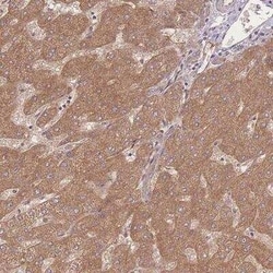 Insulin R/CD220 Antibody, Novus Biologicals:Antibodies:Primary Antibodies