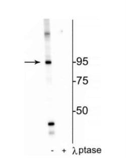 Insulin Receptor beta, p Thr1160 Antibody, Novus Biologicals 100&mu;L:Antibodies,