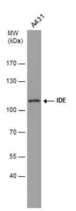 Insulysin/IDE Antibody (GT286), Novus Biologicals 100 &mu;g | Buy Online | Novus Biologicals | Fisher Scientific