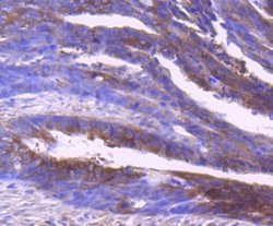 Insulysin/IDE Rabbit anti-Human, Mouse, Rat, Zebrafish, Clone: JJ0949,