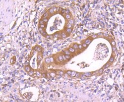 Insulysin/IDE Rabbit anti-Human, Mouse, Rat, Zebrafish, Clone: JJ0949,