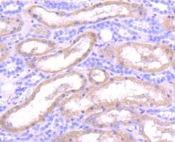 Insulysin/IDE Rabbit anti-Human, Mouse, Rat, Zebrafish, Clone: JJ0949,