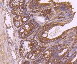 Insulysin/IDE Rabbit anti-Human, Mouse, Rat, Zebrafish, Clone: JJ0949,