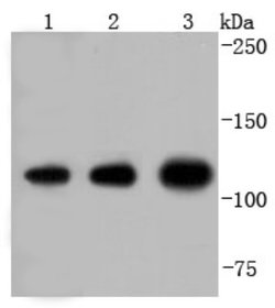 Insulysin/IDE Rabbit anti-Human, Mouse, Rat, Zebrafish, Clone: JJ0949,