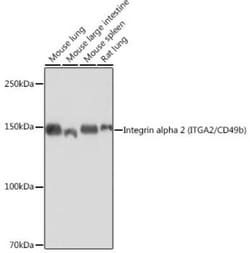 Integrin alpha 2/CD49b Rabbit anti-Human, Mouse, Rat, Clone: 7O9H6, Novus
