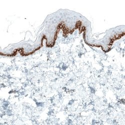 Integrin alpha 2/CD49b Antibody (CL7318), Novus Biologicals Integrin alpha
