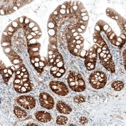 Integrin alpha 2/CD49b Antibody (CL7318), Novus Biologicals Integrin alpha