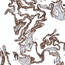 Integrin alpha 3/CD49c Antibody (CL6937), Novus Biologicals Integrin alpha