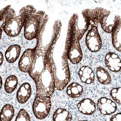 Integrin alpha 3/CD49c Antibody (CL6937), Novus Biologicals Integrin alpha