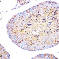 Integrin alpha 4/CD49d Rabbit anti-Human, Mouse, Rat, Clone: 8M8C2, Novus